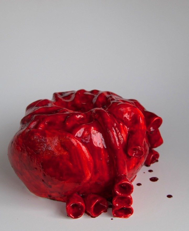 anatomical heart cake